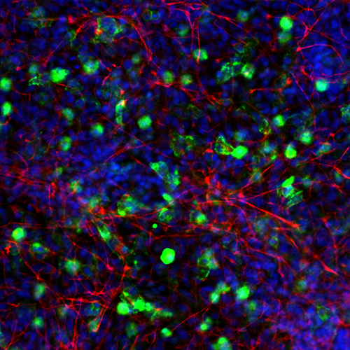 In vitro test - Neuro Inflammation - Brain inflammation in rat primary ...