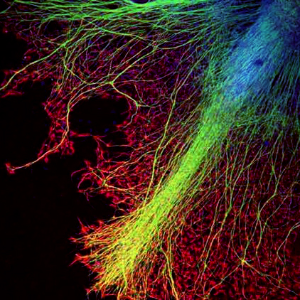 In vitro test - Spinal cord injury - Motor unit rat nerve - human ...